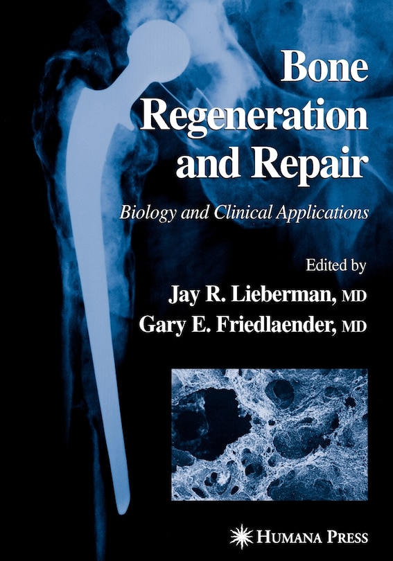 Front cover_Bone Regeneration and Repair