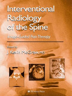 Front cover_Interventional Radiology of the Spine