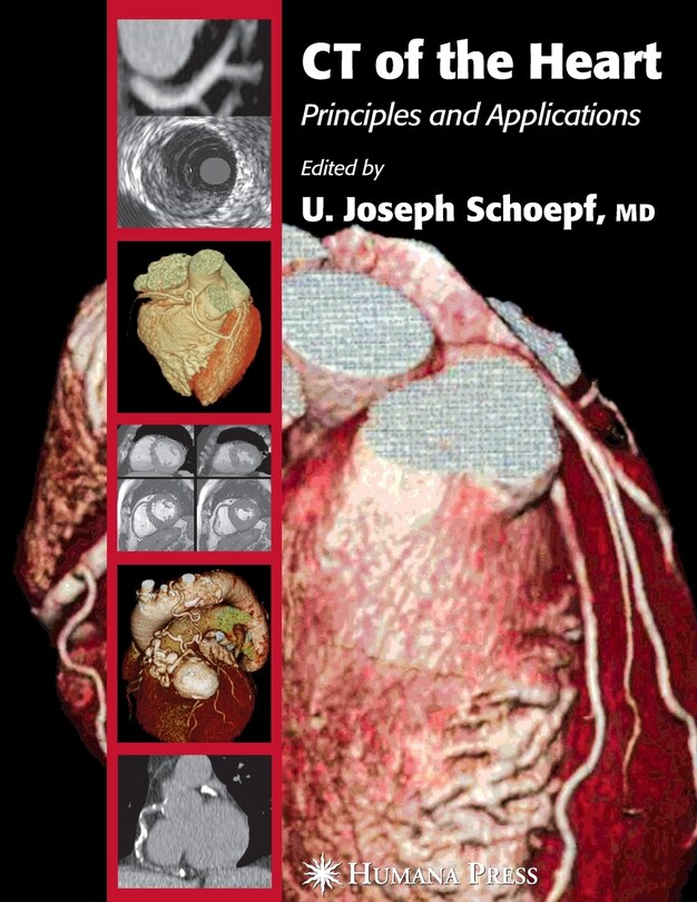 Front cover_CT of the Heart