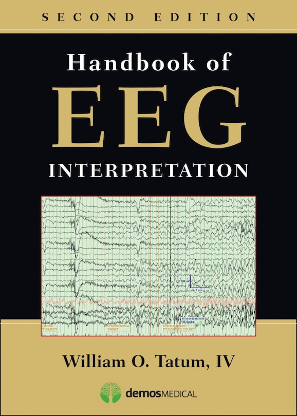 Front cover_Handbook Of Eeg Interpretation