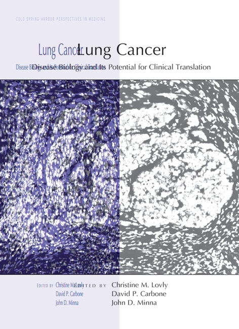 Lung Cancer: Disease Biology And Its Potential For Clinical Translation