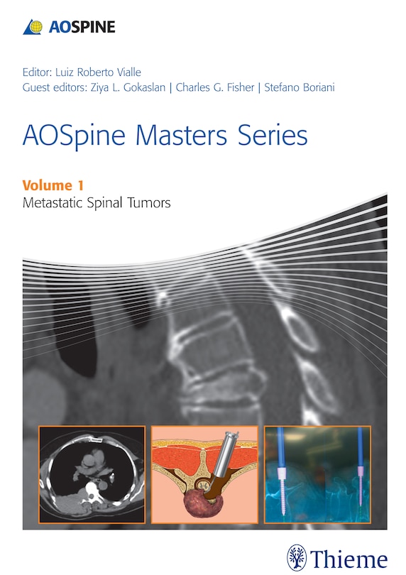 Front cover_Aospine Masters Series Volume 1