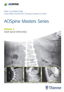 Couverture_Aospine Master Series, Vol. 4