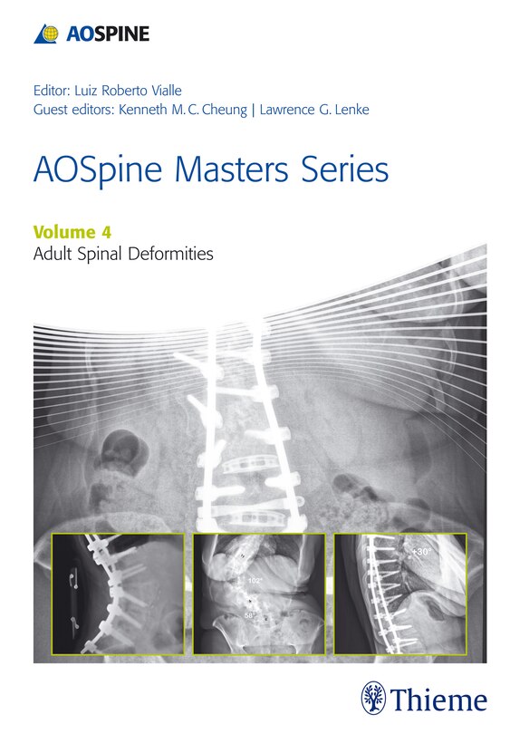 Couverture_Aospine Master Series, Vol. 4