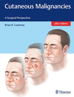 Front cover_Cutaneous Malignancies