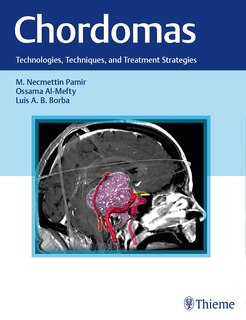 Front cover_Chordomas
