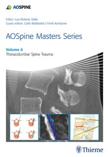 Front cover_Aospine Masters Series, Volume 6