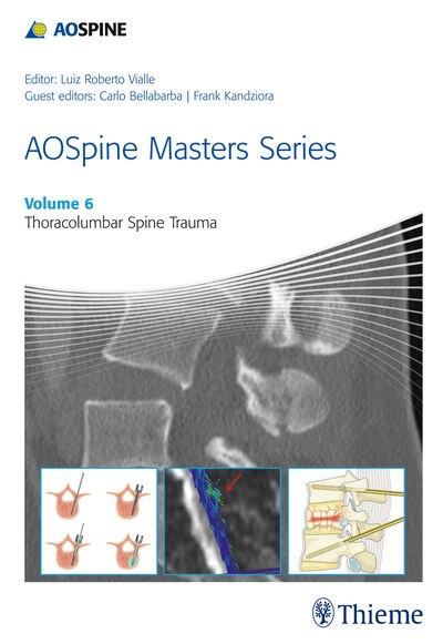 Front cover_Aospine Masters Series, Volume 6