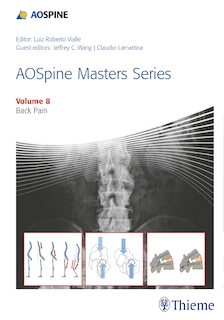 Front cover_Aospine Masters Series, Volume 8