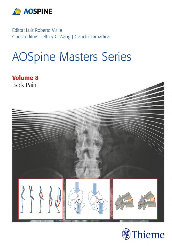 Front cover_Aospine Masters Series, Volume 8