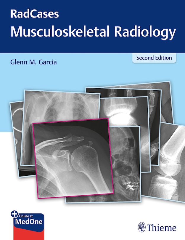 Front cover_Radcases Q And A Musculoskeletal Radiology