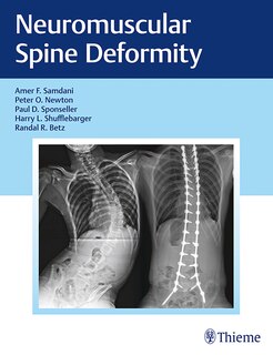 Front cover_Neuromuscular Spine Deformity