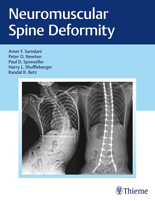 Front cover_Neuromuscular Spine Deformity