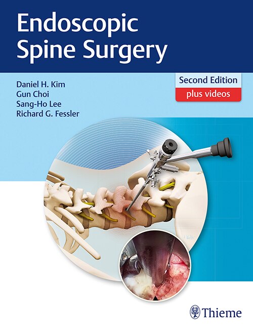 Couverture_Endoscopic Spine Surgery