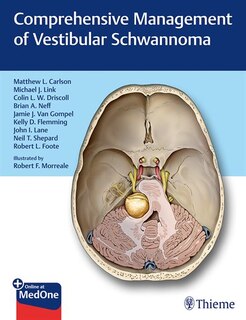Front cover_Comprehensive Management of Vestibular Schwannoma