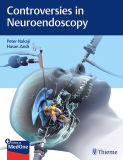 Couverture_Controversies In Neuroendoscopy