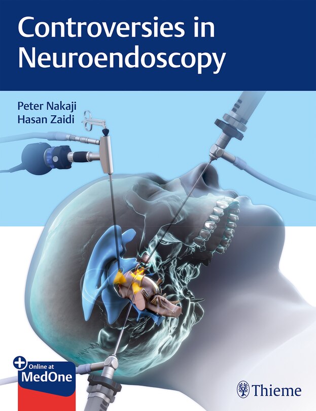 Couverture_Controversies In Neuroendoscopy