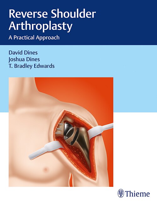 Couverture_Reverse Shoulder Arthroplasty