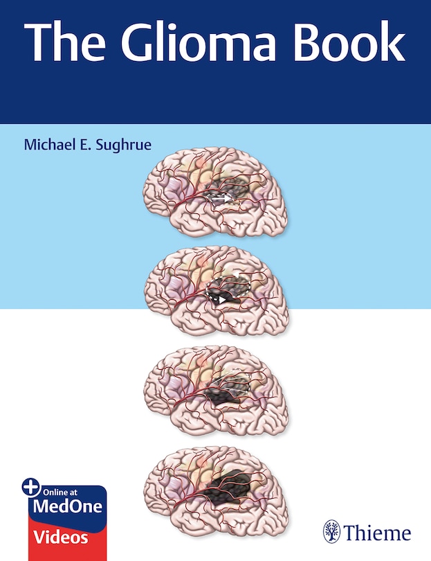 Front cover_The Glioma Book