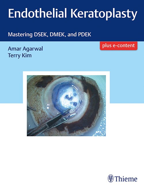 Front cover_Endothelial Keratoplasty