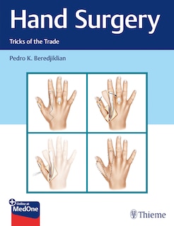 Couverture_Hand Surgery