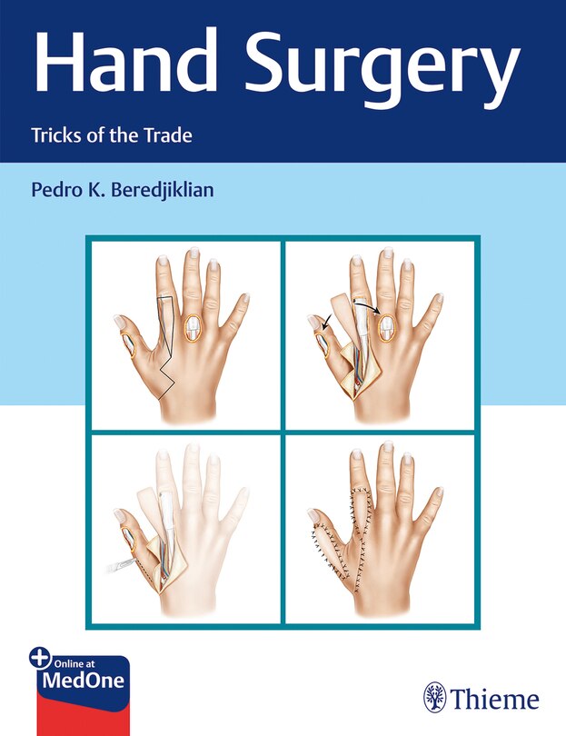 Couverture_Hand Surgery