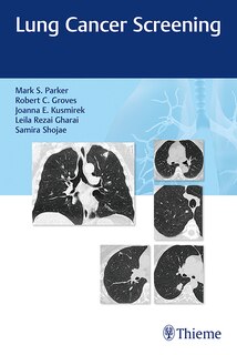Front cover_Lung Cancer Screening