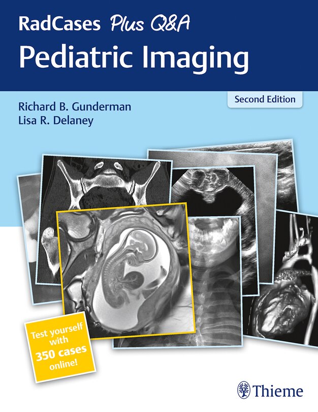 Front cover_Radcases Plus Q And A Pediatric Imaging