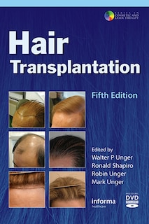 Front cover_Hair Transplantation