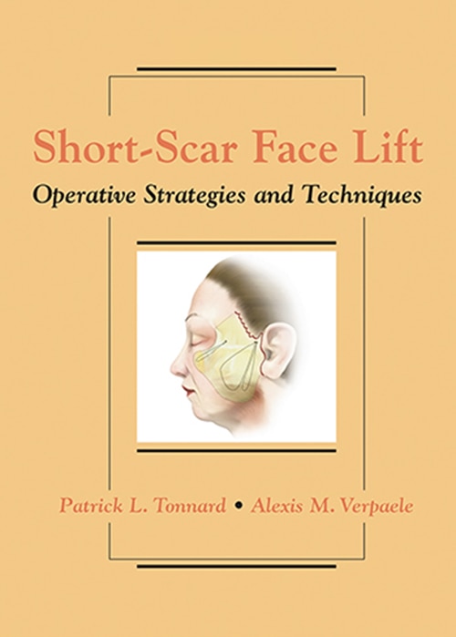 Front cover_Short-scar Face Lift