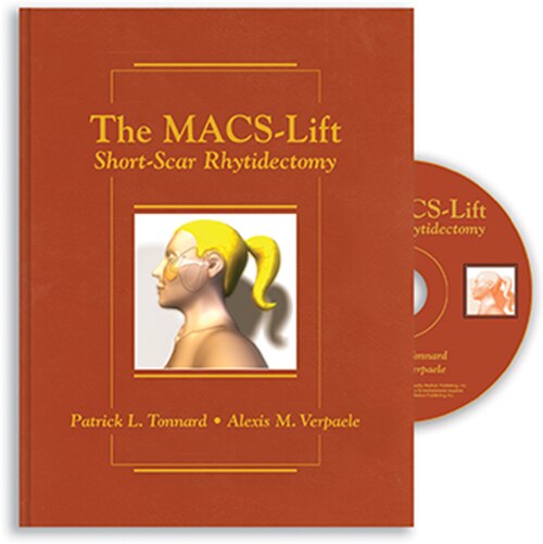 Front cover_The Macs-lift