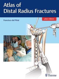 Atlas Of Distal Radius Fractures