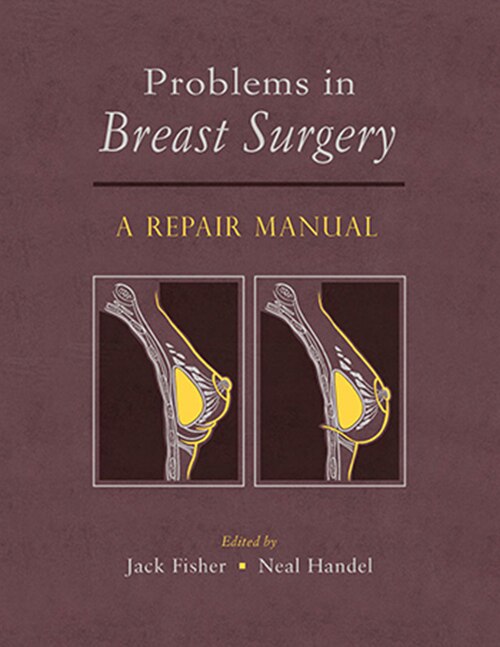 Couverture_Problems In Breast Surgery