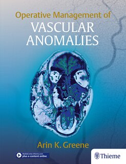 Couverture_Operative Management Of Vascular Anomalies