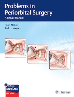 Couverture_Problems In Periorbital Surgery