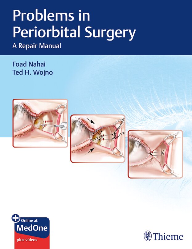Couverture_Problems In Periorbital Surgery