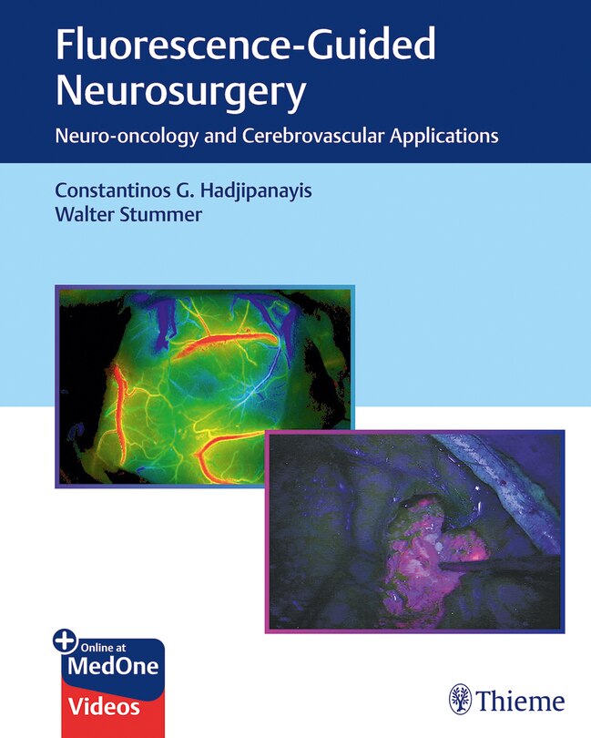 Front cover_Fluorescence-guided Neurosurgery