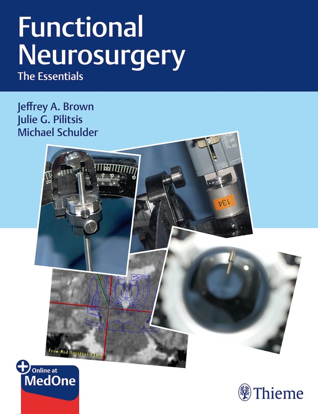 Couverture_Functional Neurosurgery