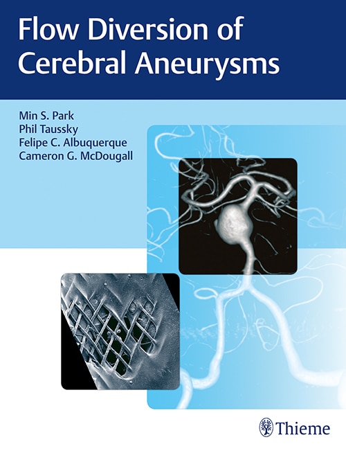 Couverture_Flow Diversion Of Cerebral Aneurysms