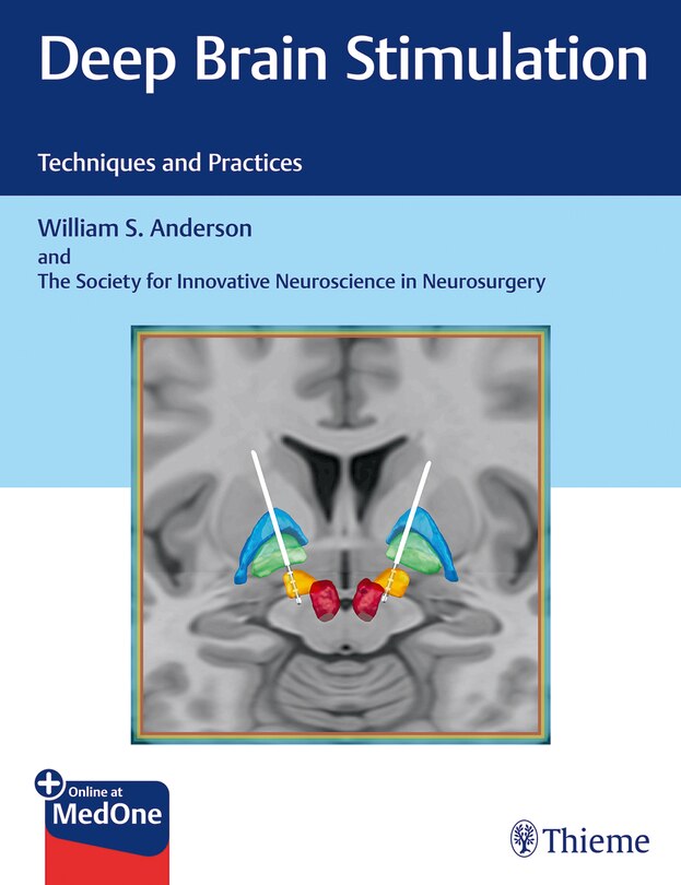 Front cover_Deep Brain Stimulation
