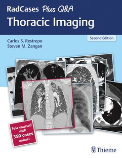 Front cover_Radcases Plus Q And A Thoracic Imaging