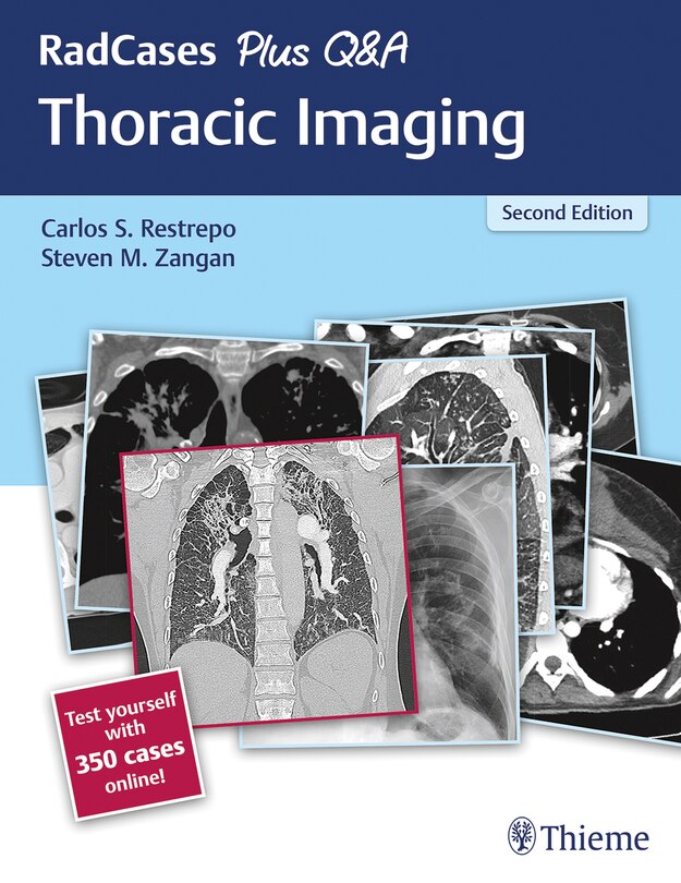 Front cover_Radcases Plus Q And A Thoracic Imaging