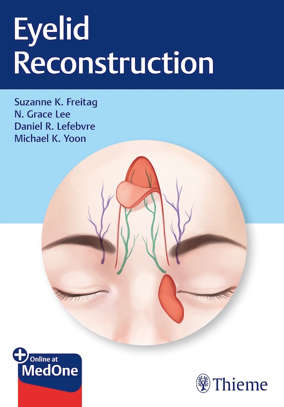Couverture_Eyelid Reconstruction