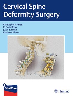 Couverture_Cervical Spine Deformity Surgery