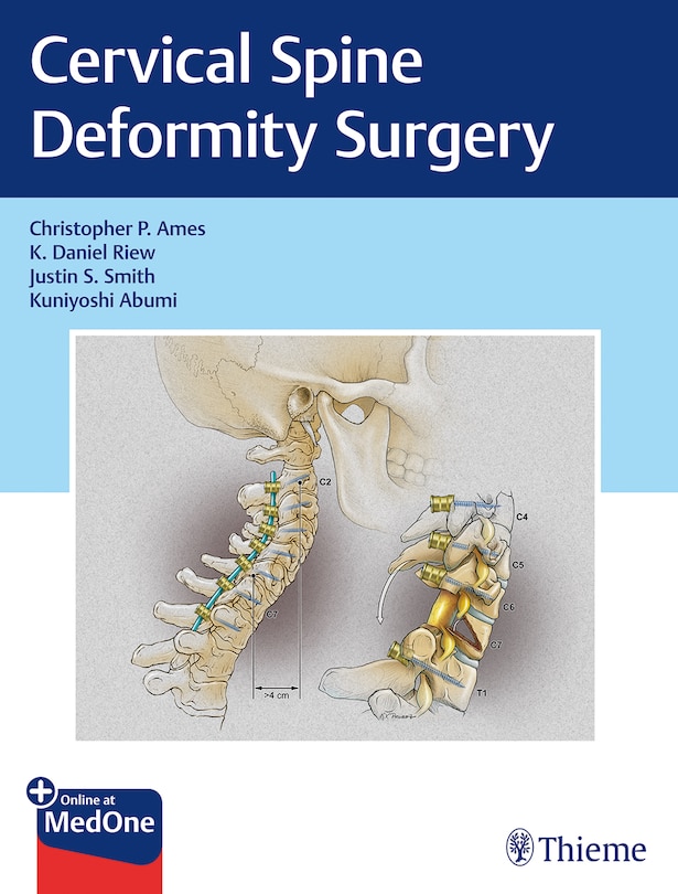 Couverture_Cervical Spine Deformity Surgery