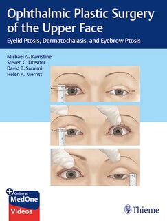 Front cover_Ophthalmic Plastic Surgery Of The Upper Face