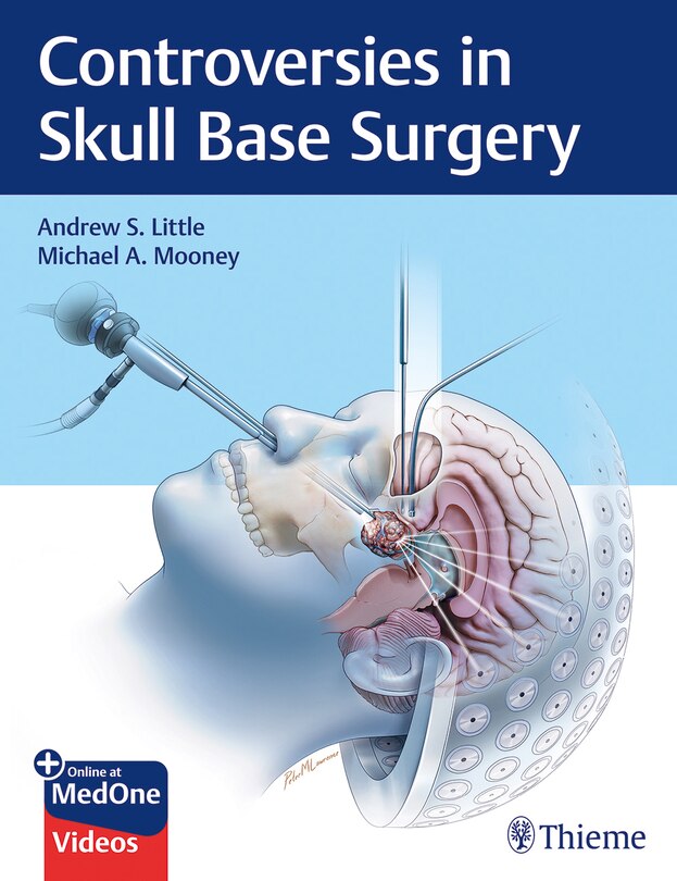 Front cover_Controversies In Skull Base Surgery