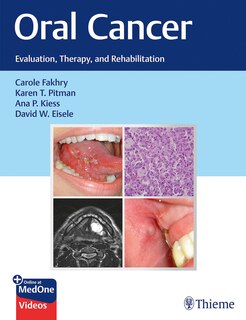 Front cover_Oral Cancer