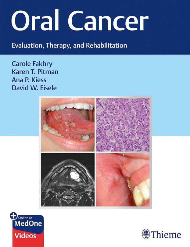 Front cover_Oral Cancer
