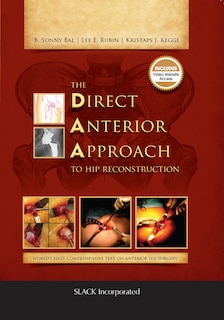 Front cover_The Direct Anterior Approach To Hip Reconstruction